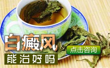 男性白癜风，白癜风症状有哪些